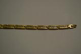 Jewellery is an alloy of health Jewellery is an alloy of health